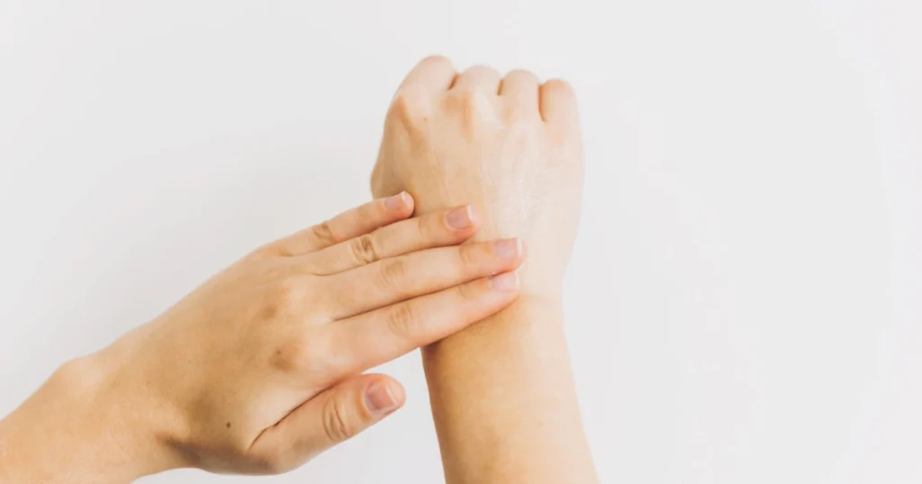 tangan kering dan pecah pecah