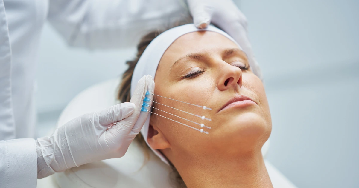 manfaat tarik benang wajah