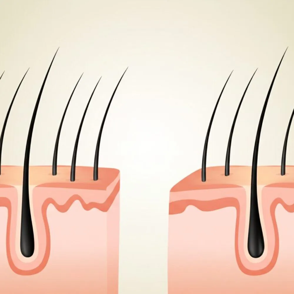 Memahami-Botak-Penyebab-Jenis-dan-Cara-Mengatasi-Kebotakan